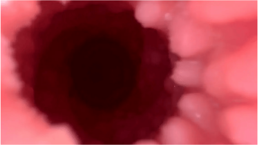 Realistic Suction