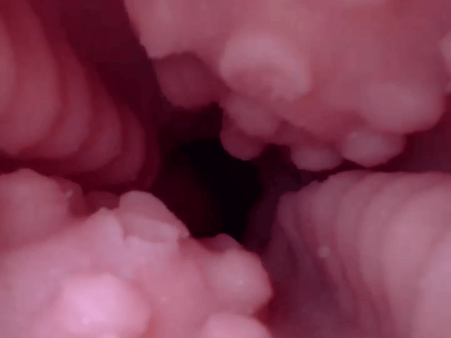 3D Textured Channel