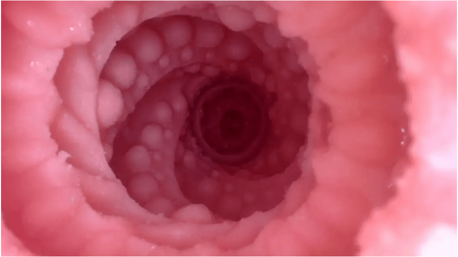 3D Textured Channel